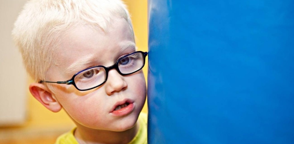 Las personas con albinismo tienen como característica común: la discapacidad visual severa. También pueden manifestar una alteración en la pigmentación. /  Ana Yturralde / CNB